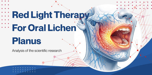 Blog Hero Image How CuraYou's OralRevive Elite Applies Red Light Therapy for Oral Lichen Planus